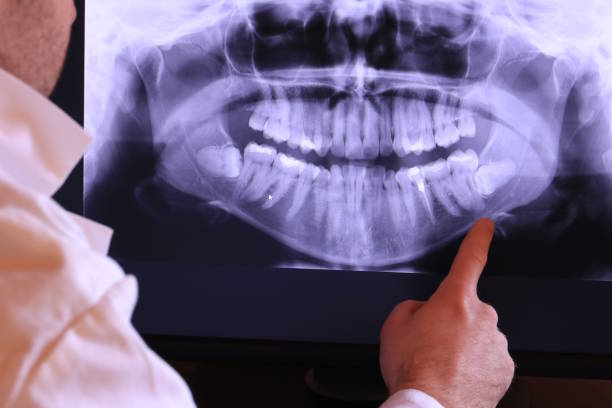 Best Root Canal Emergency Dentist  in South Wallins, KY