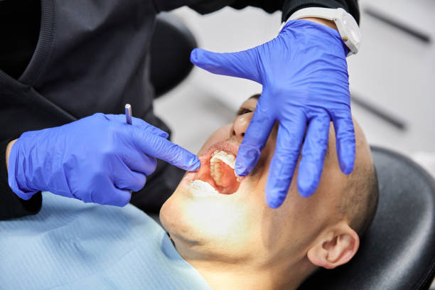 Best Knocked-Out Tooth Emergency  in South Wallins, KY